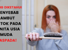 Penyebab Rambut Rontok Pada Wanita Usia Muda